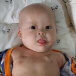 Kisah Chiara, Bayi 8 Bulan Berjuang Melawan Tumor Ganas dan Kondisi Langka Lainnya
